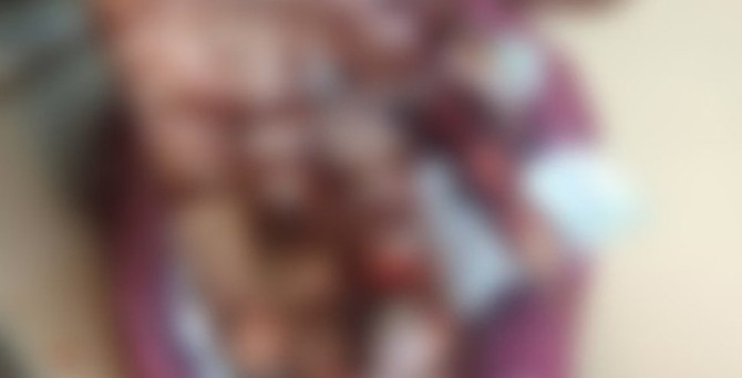 Patlayıcı kendi üzerinde infilak etti: 1 ölü, 3 yaralı