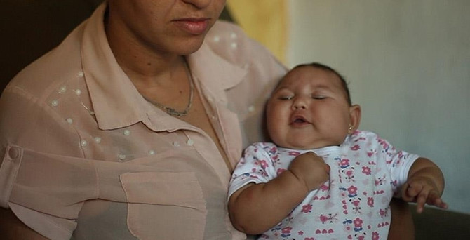 ABD ve Kanada'da Zika virüsü görüldü