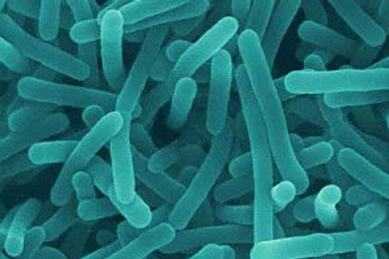 Listeria salgınında ölü sayısı 18'e çıktı