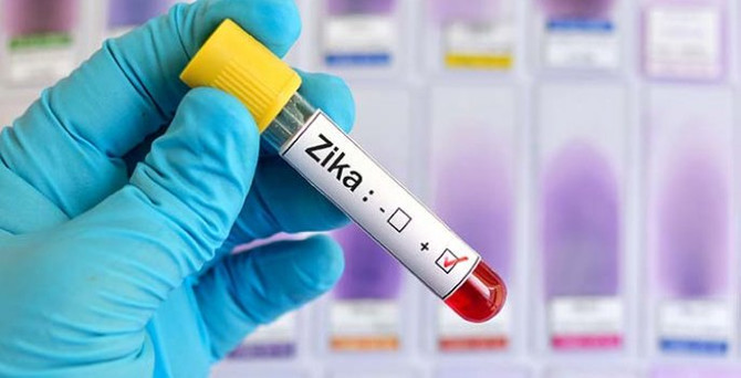 Zika aşısı maymunlarda işe yaradı