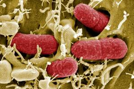 Kanada’da Ebola virüsü şüphesi