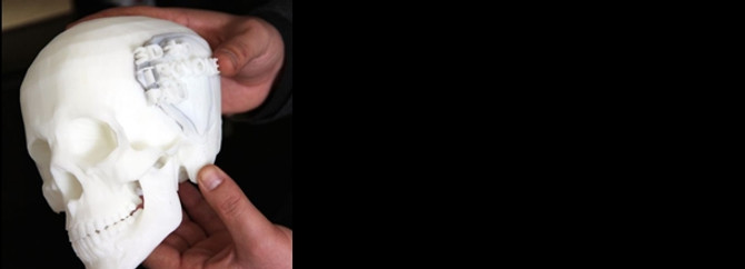 3 boyutlu yazıcıyla "protez vücut" ürettiler