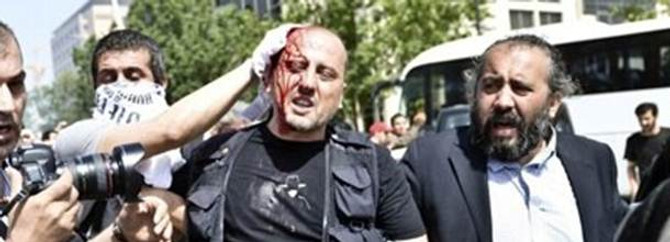 Ahmet Şık eylemde yaralandı