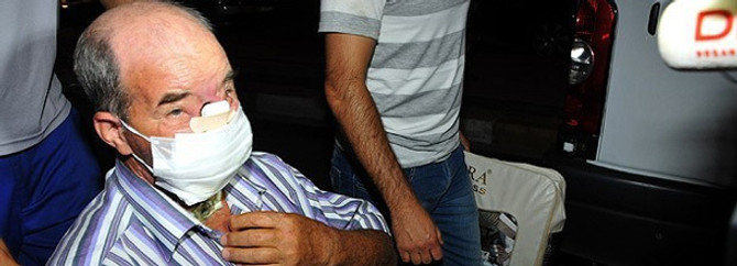 Yüz nakliyle 23 yaş gençleşti