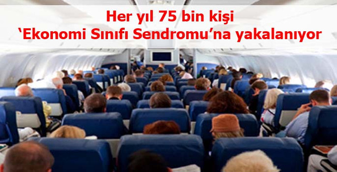 Uzun uçuşlar her yıl, 75 bin kişiye 'ekonomi sınıfı sendromu' yaşatıyor