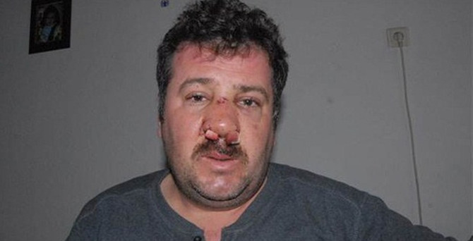 Kaskıyla darp yapan polise soruşturma açıldı