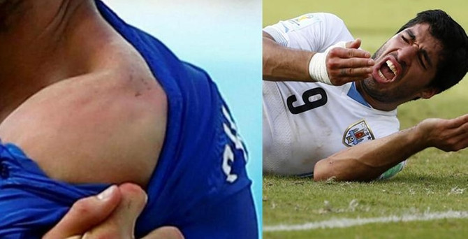 Suarez'e tarihi 'ısırık' cezası