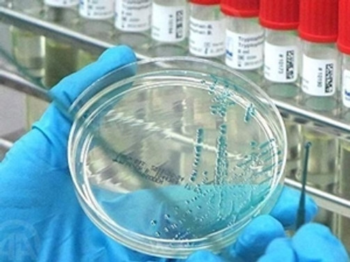 Ebola'dan ölenlerin sayısı bin 350'ye çıktı