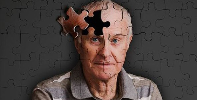 Unutkanlık mı Alzheimer mi?