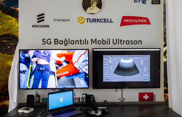 Turkcell, sağlık sektörü için 5G şebeke deneyimi gerçekleştirdi