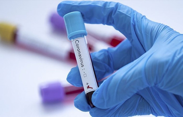 Sağlık Bakanı Koca, ikinci koronavirüs vakasını açıkladı