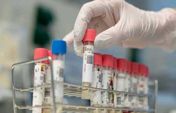 İran'da 103 yaşındaki kadın koronavirüsü yendi