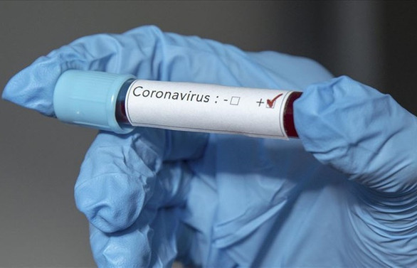 ABD’de 5 dakikada sonuç veren koronavirüs test kiti geliştirildi