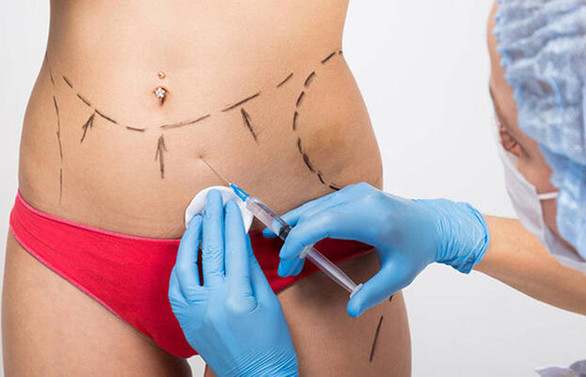 Klasik liposuction yöntemleri ile lipomatik yöntemi arasındaki farklar neler?