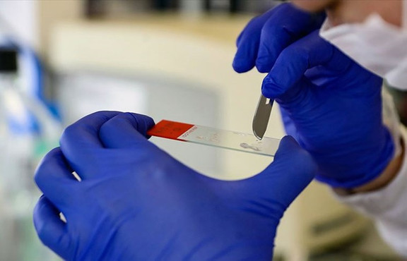 AstraZeneca ABD'de aşı testlerine devam etmek için FDA'dan onay bekliyor