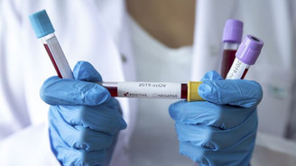 bes farkli sigorta sirketi koronavirus