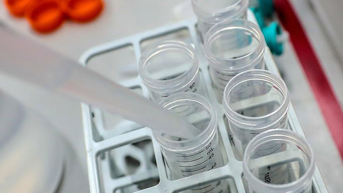 Oruç, kök hücrelerin yenilenme fonksiyonunu artırıyor