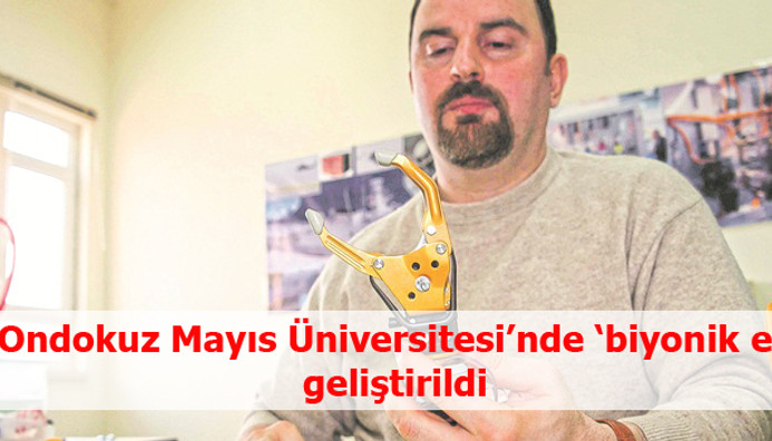 omu de biyonik el gelistirildi