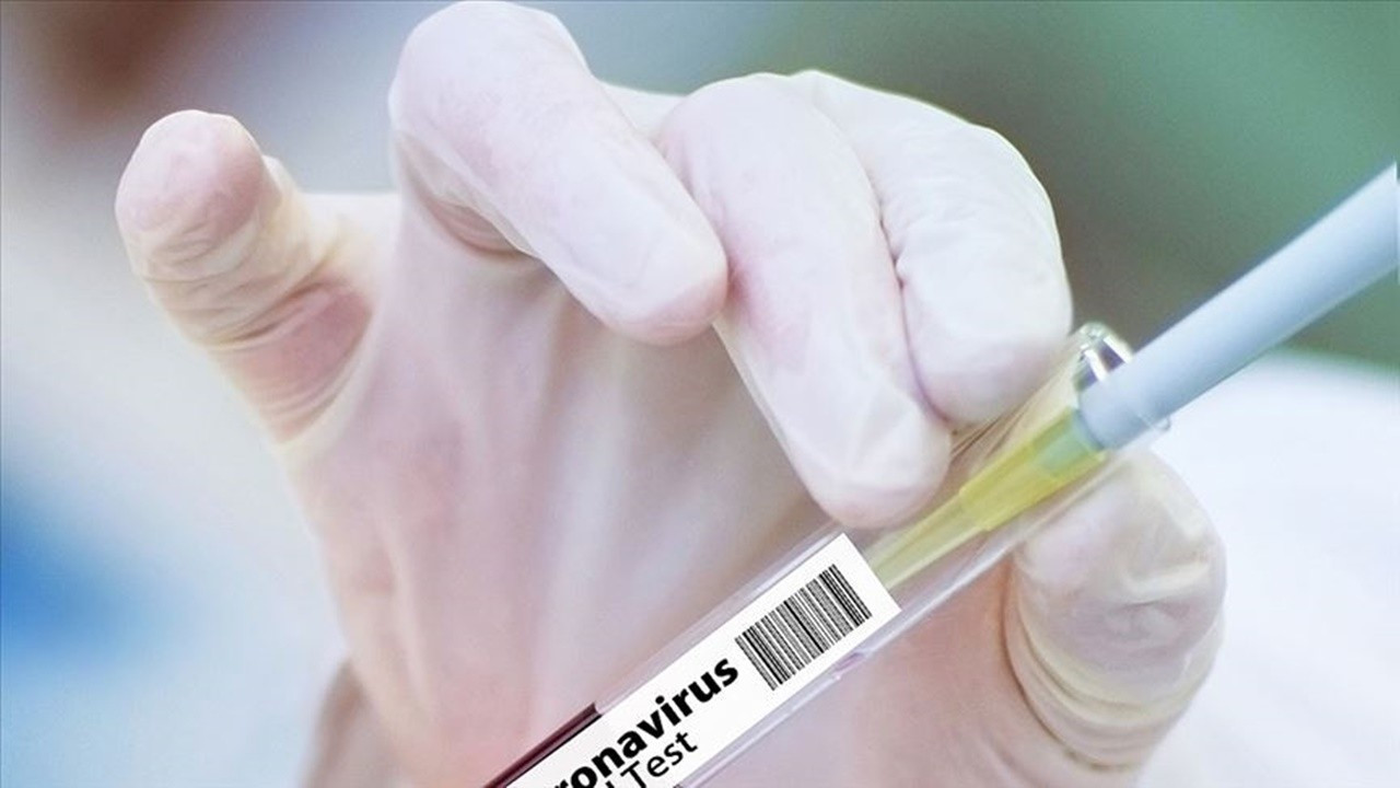 Rusya'da 2. aşı adayının 3. faz deneyleri başladı