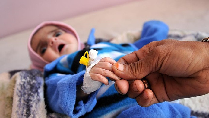 'Yemen'de 10 dakikada 1 çocuk ölüyor'