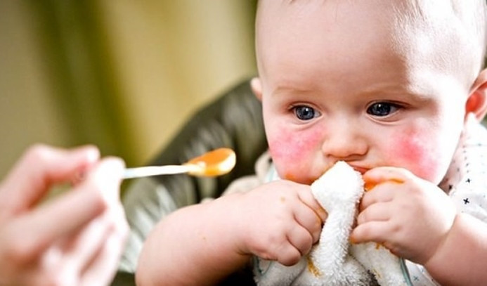 Çocuklarda besin alerjisi farkındalığı için kampanya başlatıldı
