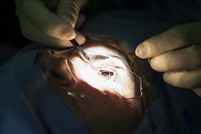 13 Afrika ülkesinde katarakt ameliyatı yapılacak